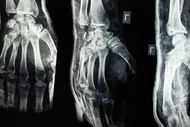 Bones, Joints, and the Ratio Nobody's Talking About: The Ca:P Problem Hidden in Your Dog's Bowl